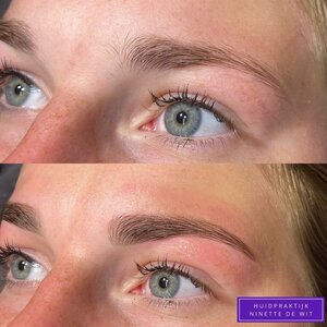 Huid- & Laser Praktijk Ninette de Wit image 1